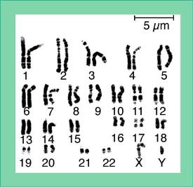 karotype sample