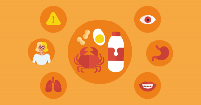 What is a food allergy? Symptoms, causes and treatment